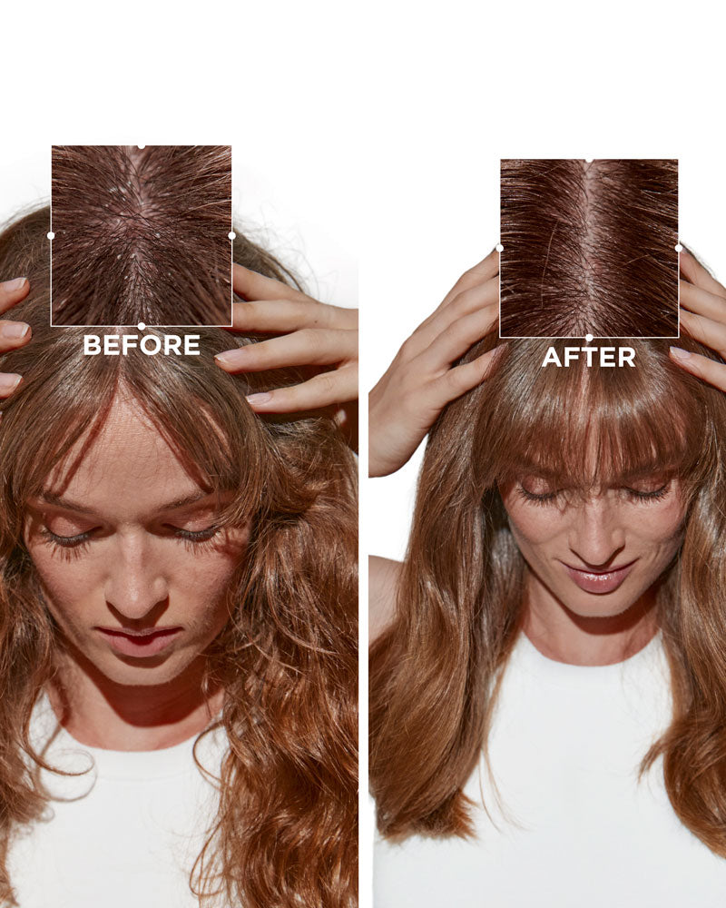 Symbiose Sérum Cellulaire Nuit Anti-Pelliculaire Intensif