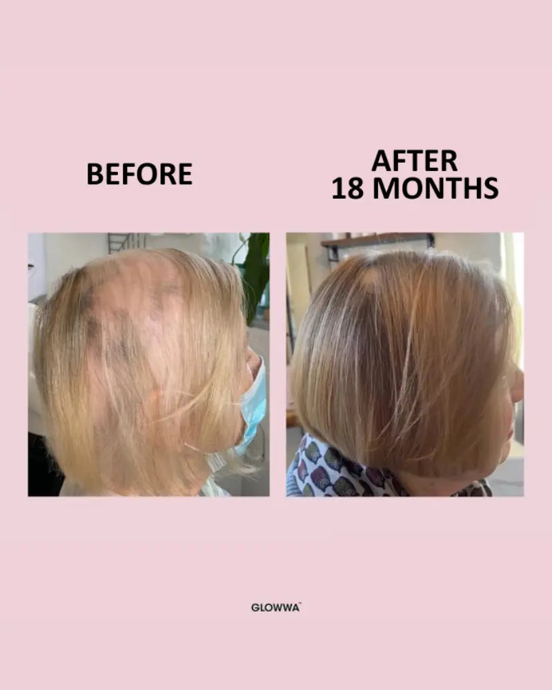 Hair Food™ 1 Month Supply