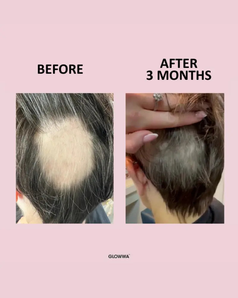 Hair Food™ 1 Month Supply