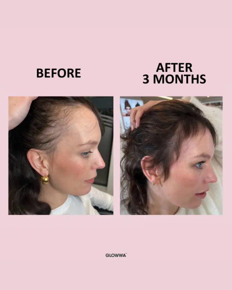 Hair Food™ Hair Vitamins - 1 Month Supply