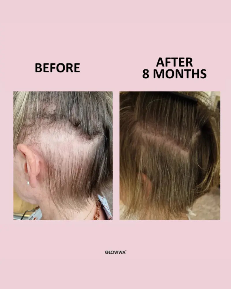 Hair Food™ Hair Vitamins