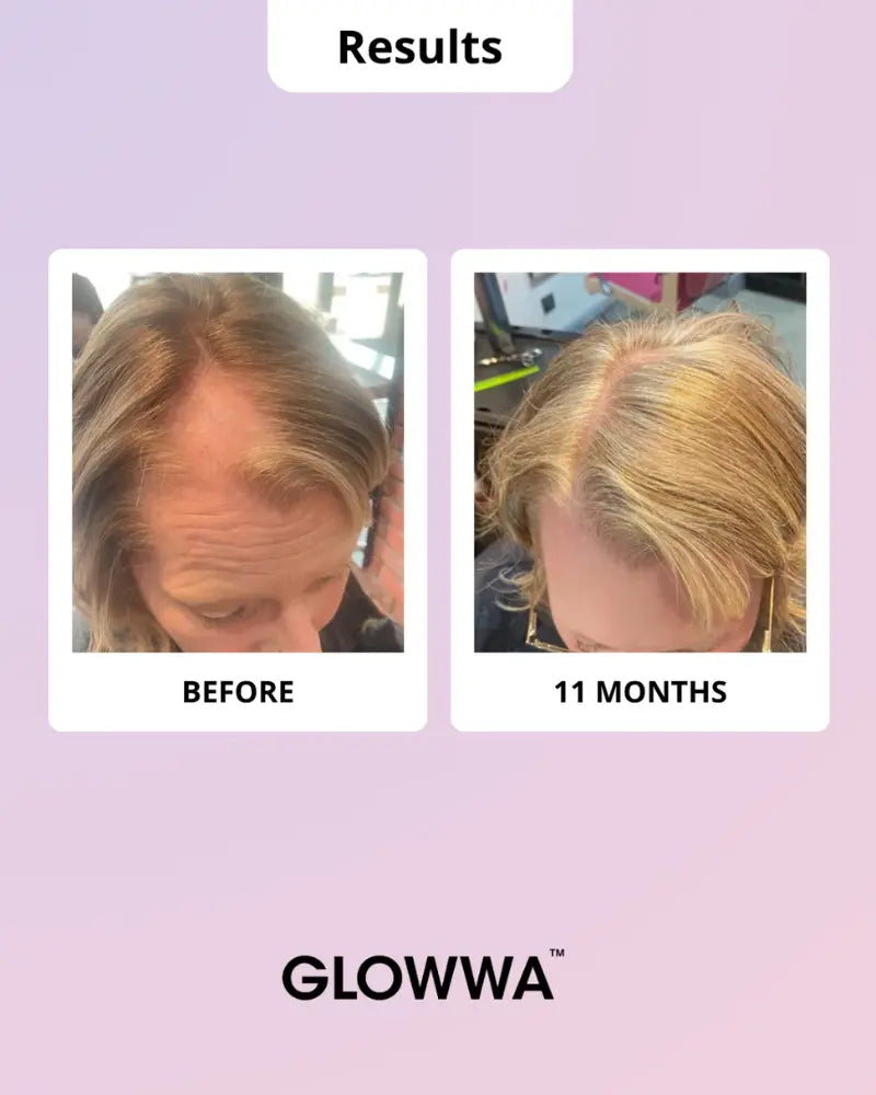 Hair Food™ Menopause Hair Vitamins