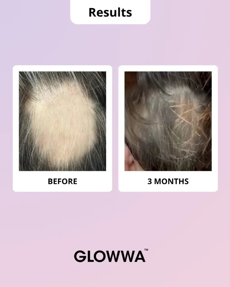 Hair Food™ Menopause Hair Vitamins