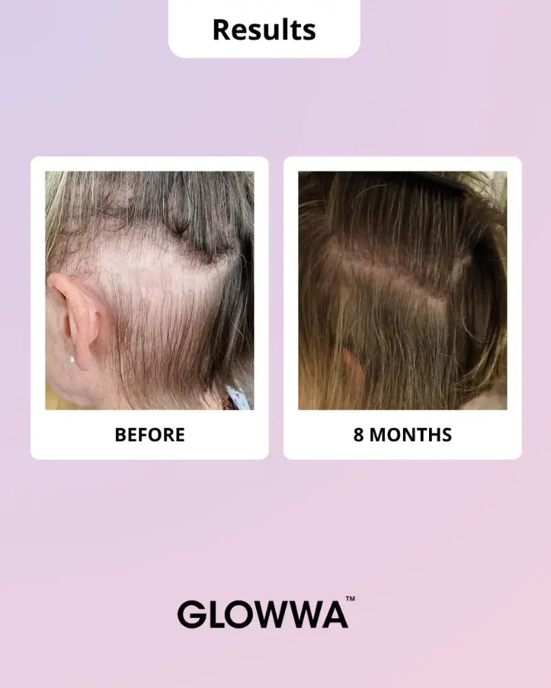 Hair Food™ Menopause Hair Vitamins