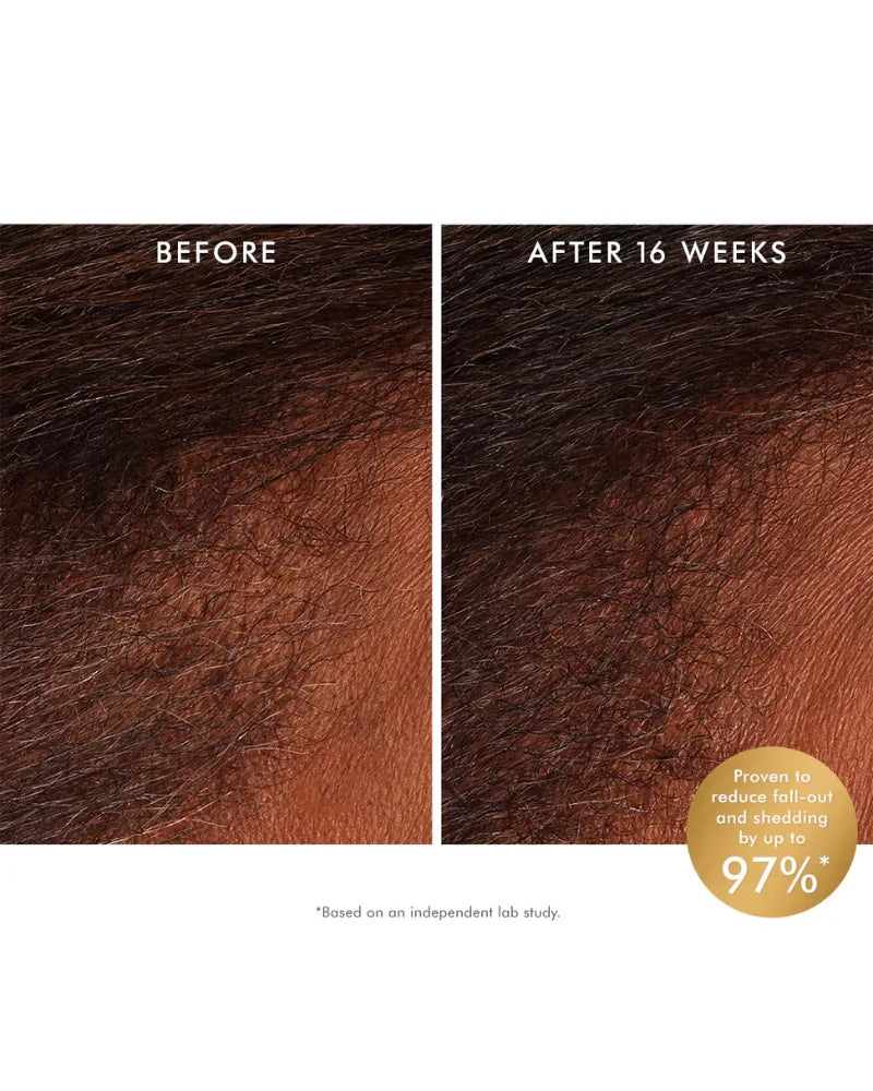 Revitalizing Scalp Tonic