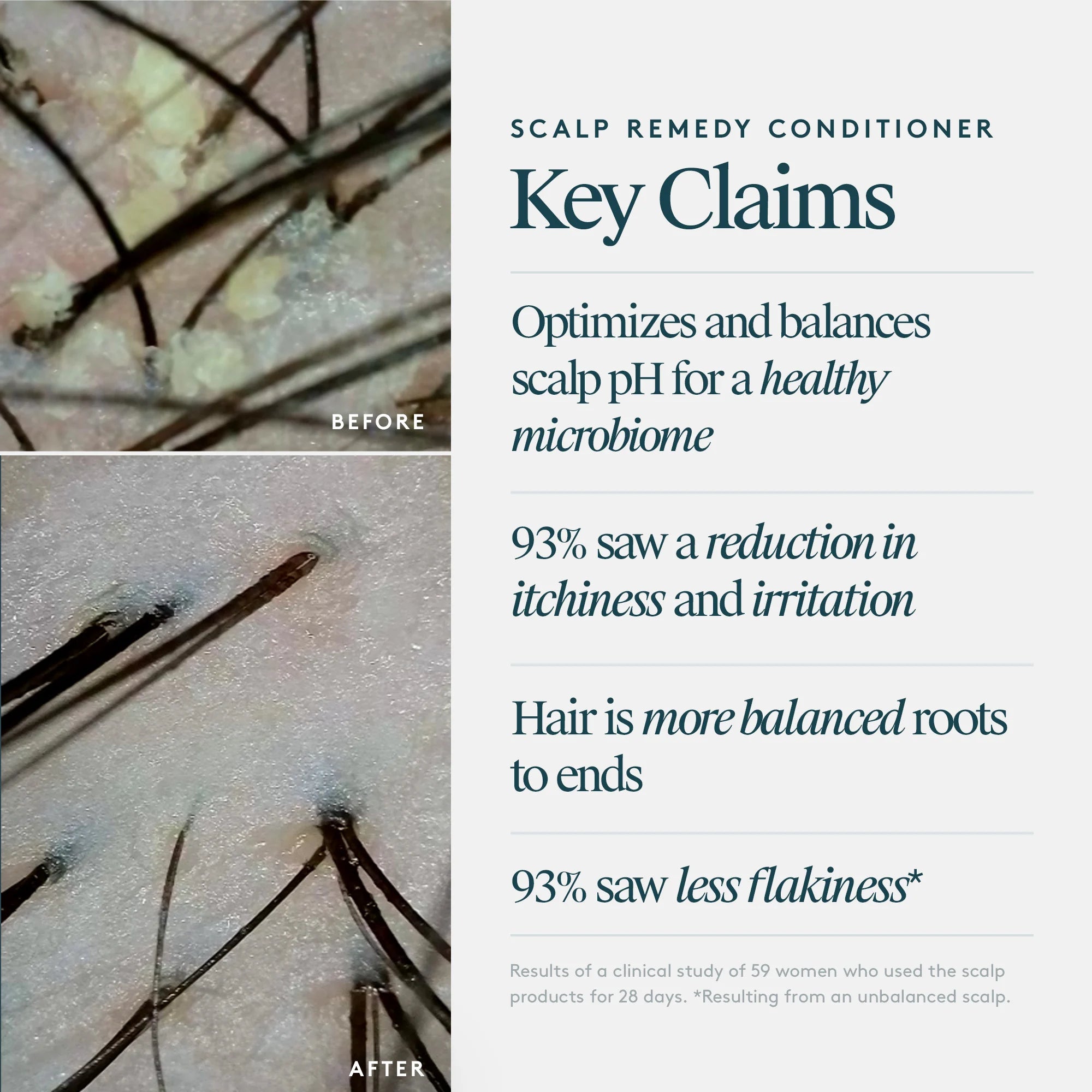 Scalp Remedy Conditioner