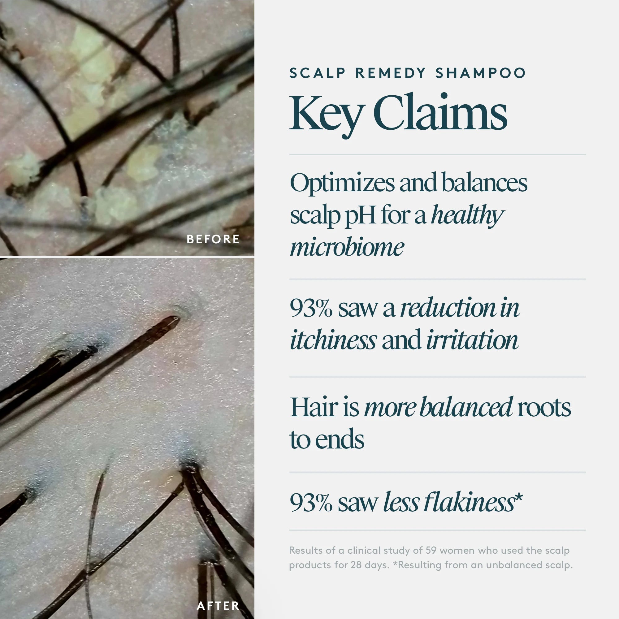 Scalp Remedy Shampoo