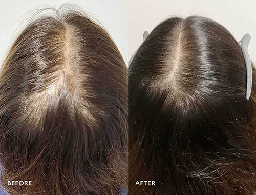 Pro Clinical Hair Loss Solution