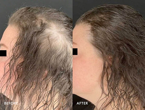Deluxe Clinical Hair Loss Solution