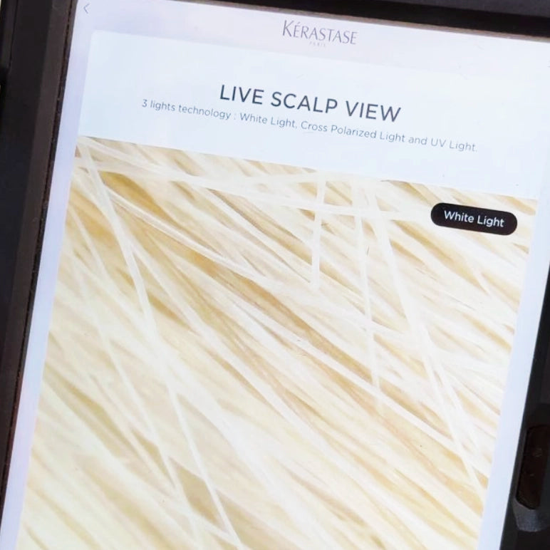 Healthy Scalp & Ends