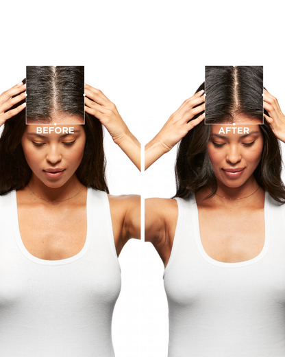 Kerastase Symbiose Crème Anti-Dandruff Shampoo for Dry Scalp