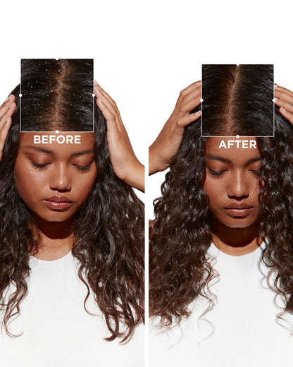 Kerastase Symbiose Pureté Anti-Dandruff Shampoo for Oily Scalp