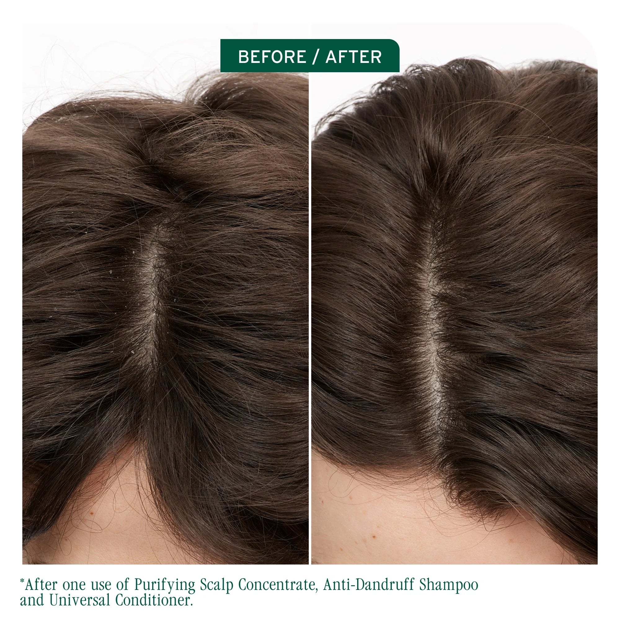 Scalp Sync Anti Dandruff Shampoo