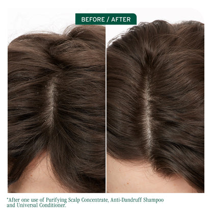 Scalp Sync Anti Dandruff Shampoo