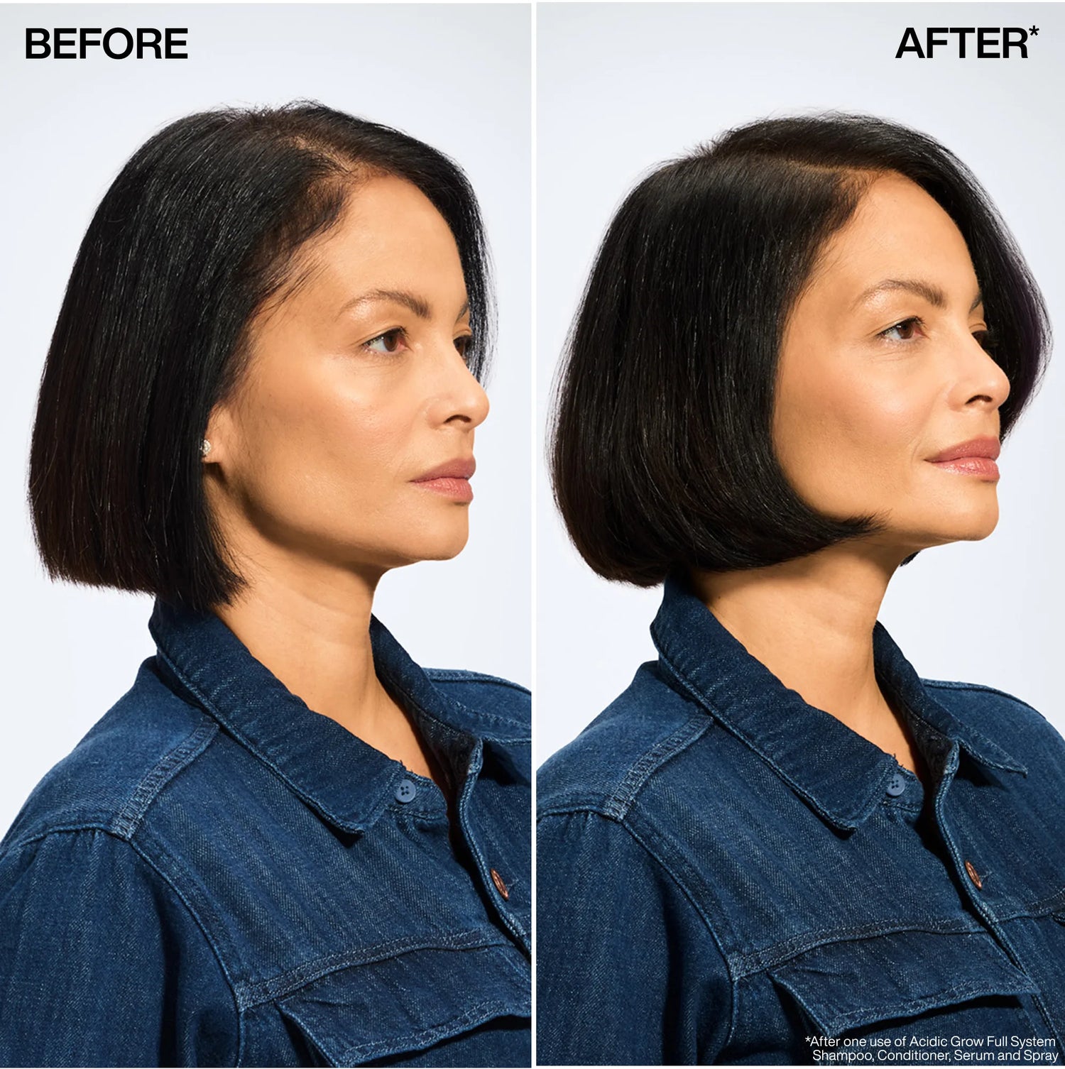 Acidic Grow Full System Serum
