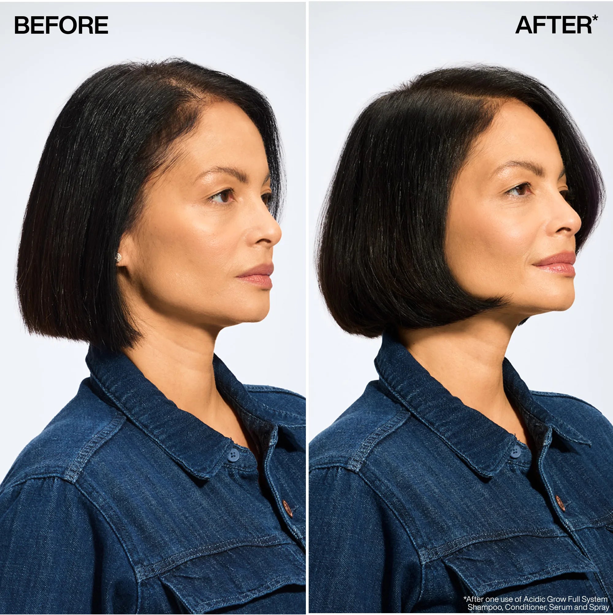 Acidic Grow Full System Serum