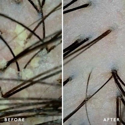 Exfoliating Scalp Treatment
