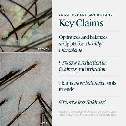 Scalp Remedy Conditioner
