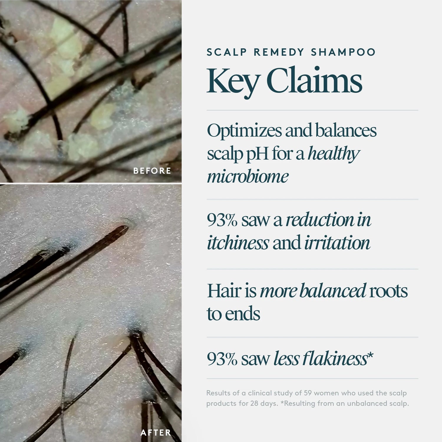 Scalp Remedy Shampoo