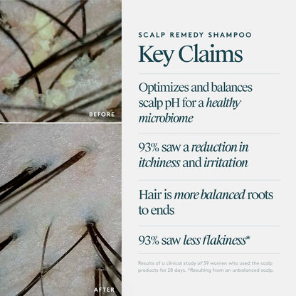 Scalp Remedy Shampoo